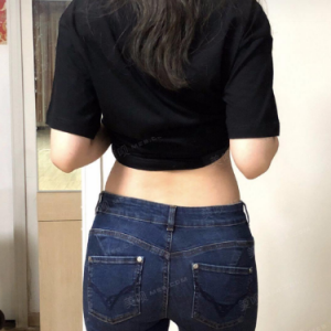 北京可思美整形醫(yī)院醫(yī)生斯勤做腰腹吸脂怎么樣？附案例效果對比圖