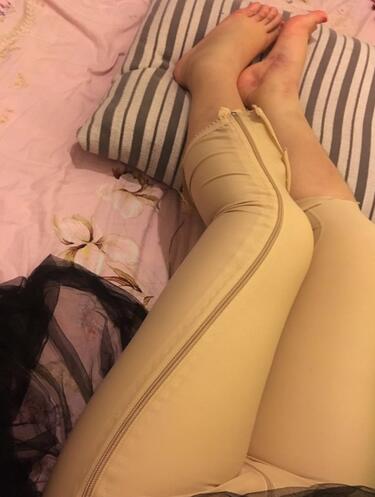 上海保加醫(yī)療美容門診部做大腿吸脂怎么樣？附楊勇醫(yī)生案例效果對比圖