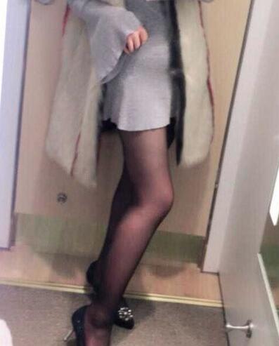 上海保加醫(yī)療美容門診部做大腿吸脂怎么樣？附楊勇醫(yī)生案例效果對比圖