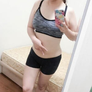 北京可思美整形醫(yī)院醫(yī)生斯勤做腰腹吸脂怎么樣？附案例效果對比圖