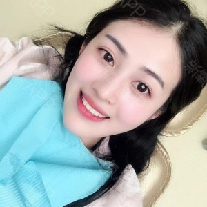 上?？仆呖谇会t(yī)院醫(yī)生鄧建儒做牙齒冷光美白怎么樣？附案例效果對比圖