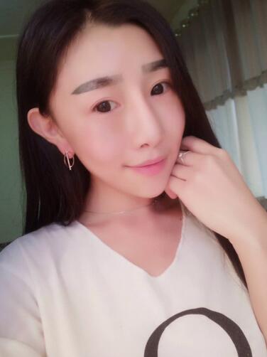 貴陽(yáng)泰康樂(lè)醫(yī)院整形美容科醫(yī)生陳璐做自體脂肪全臉填充效果怎么樣？