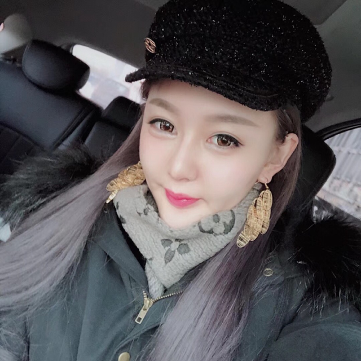 杭州格萊美整形美容醫(yī)院醫(yī)生張霞飛做自體脂肪全臉填充效果怎么樣？