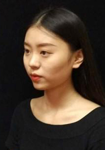 長沙星雅醫(yī)療美容醫(yī)院醫(yī)生陳煥武做埋線提升怎么樣？