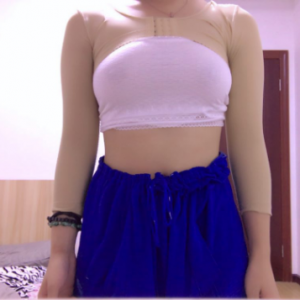 長(zhǎng)沙柒和醫(yī)療整形醫(yī)生鐘滔做手臂吸脂怎么樣？附案例效果對(duì)比圖