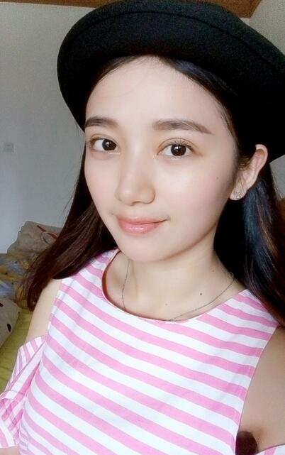 長(zhǎng)治松禾醫(yī)療美容診所醫(yī)生馬俊峰做韓式微創(chuàng)定點(diǎn)雙眼皮效果怎么樣？附案例