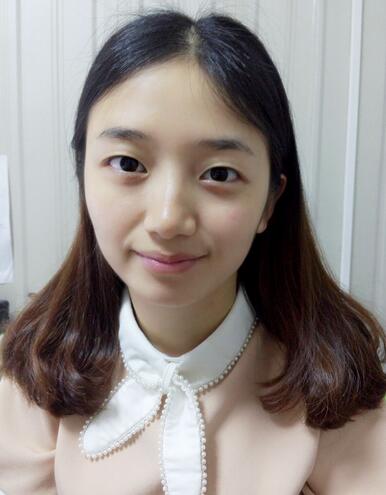 長(zhǎng)治松禾醫(yī)療美容診所醫(yī)生馬俊峰做韓式微創(chuàng)定點(diǎn)雙眼皮效果怎么樣？附案例