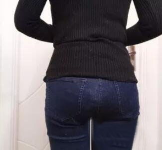 廣州尚美善造美容醫(yī)院醫(yī)生邵方做水動(dòng)力吸脂怎么樣？附案例效果圖