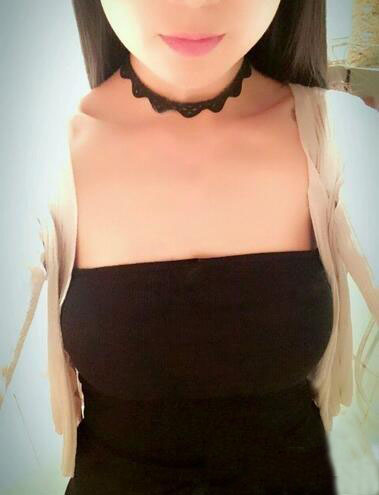 海南伊佳醫(yī)療美容醫(yī)院醫(yī)生涂陽君做假體隆胸怎么樣？附案例效果對比圖