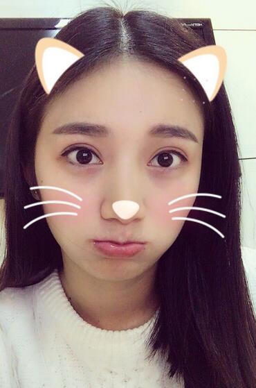 長(zhǎng)治松禾醫(yī)療美容診所醫(yī)生馬俊峰做韓式微創(chuàng)定點(diǎn)雙眼皮效果怎么樣？附案例