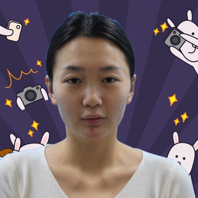 杭州格萊美整形美容醫(yī)院醫(yī)生張霞飛做自體脂肪全臉填充效果怎么樣？