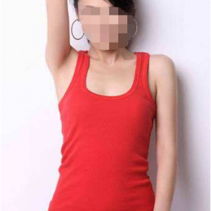 長(zhǎng)沙柒和醫(yī)療整形醫(yī)生鐘滔做手臂吸脂怎么樣？附案例效果對(duì)比圖