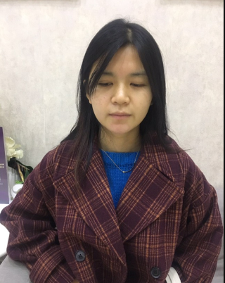 上海時(shí)光整形外科醫(yī)院醫(yī)生何晉龍做假體隆胸怎么樣？附案例效果對(duì)比圖