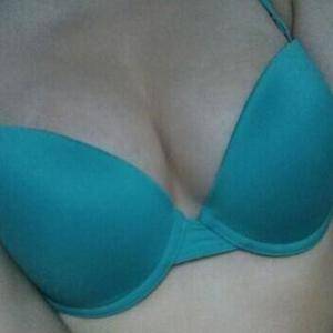 河南協(xié)和醫(yī)院整形外科醫(yī)生騰利做自體脂肪隆胸怎么樣？附案例效果對(duì)比圖