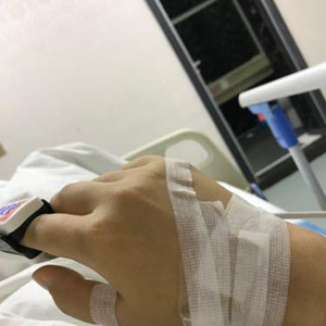 河南協(xié)和醫(yī)院整形外科醫(yī)生騰利做自體脂肪隆胸怎么樣？附案例效果對(duì)比圖