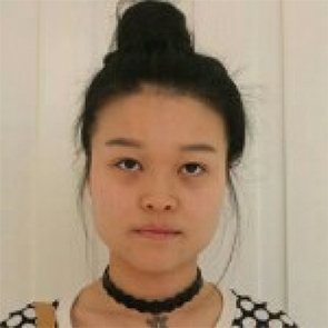 鄭州管城中醫(yī)院整形美容中心醫(yī)生張秀英做注射瘦臉怎么樣？附除皺瘦臉案例效果圖