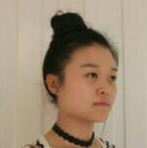 鄭州管城中醫(yī)院整形美容中心醫(yī)生張秀英做注射瘦臉怎么樣？附除皺瘦臉案例效果圖