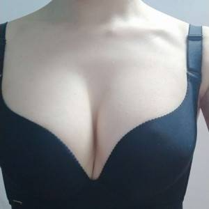 長沙亞韓醫(yī)學(xué)美容醫(yī)院醫(yī)生鄭京湘做假體隆胸怎么樣？附醫(yī)生案例效果對比圖