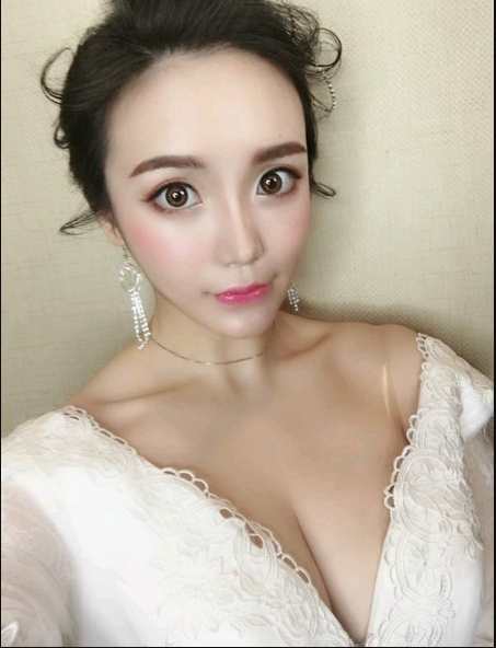 重慶當(dāng)代整形美容醫(yī)院醫(yī)生楊健做假體隆胸怎么樣？附案例