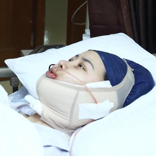 上海時光整形外科醫(yī)院醫(yī)生李靜林做假體隆鼻和反頜手術(shù)怎么樣？