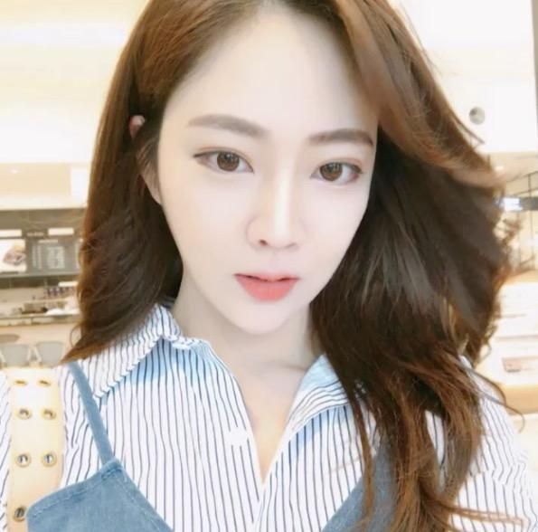 廣州中科美整形醫(yī)院醫(yī)生鄭志敏做鼻部多項(xiàng)綜合整形怎么樣？附案例效果圖