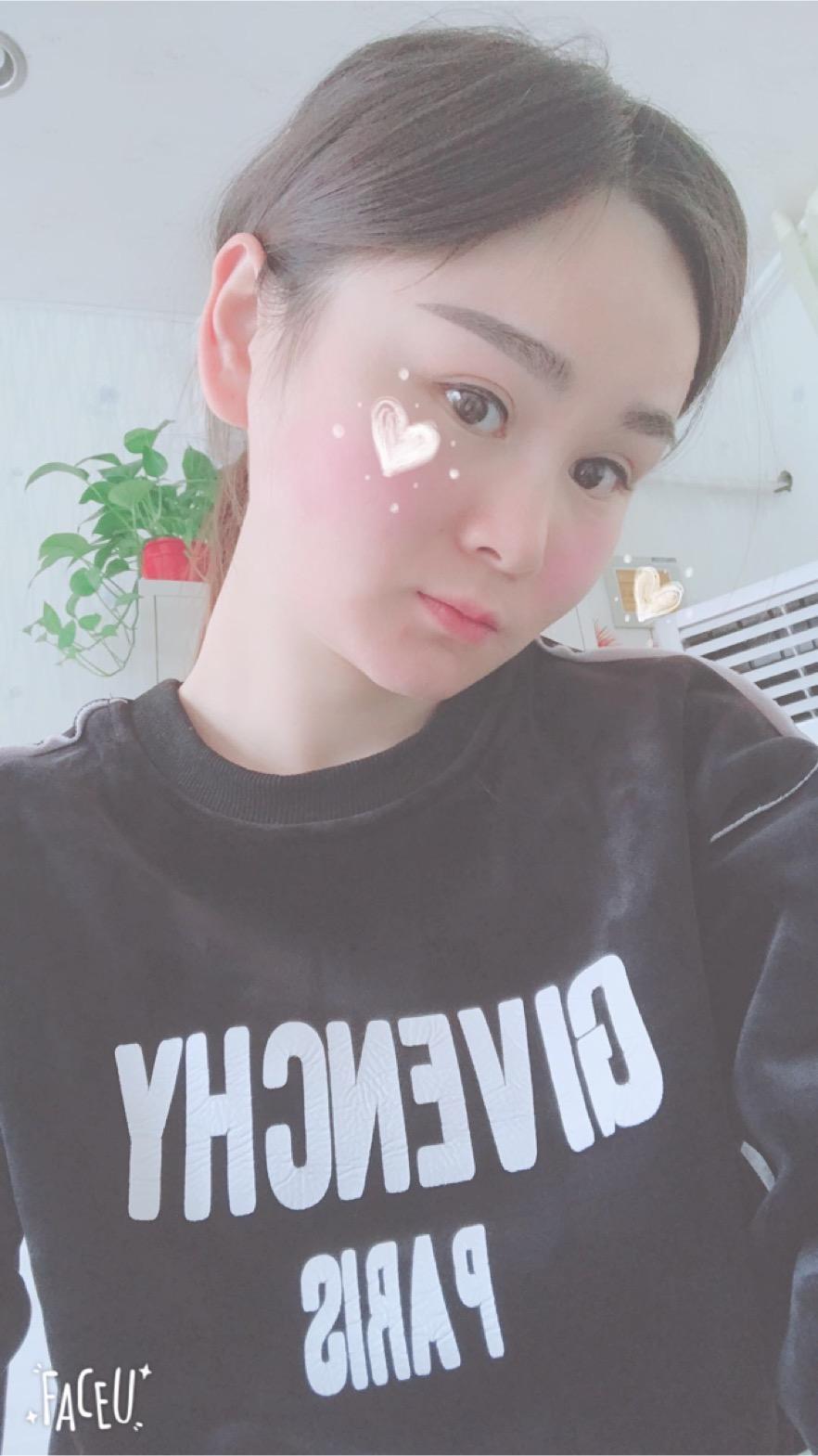 北京彤美美容整形醫(yī)院醫(yī)生楊曉惠做顴骨內(nèi)推+面部吸脂手術(shù)效果怎么樣？附案例