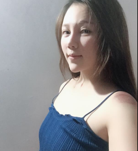 北京東方和諧醫(yī)療整形診所馮斌醫(yī)生做假體隆胸怎么樣？附案例效果對(duì)比圖