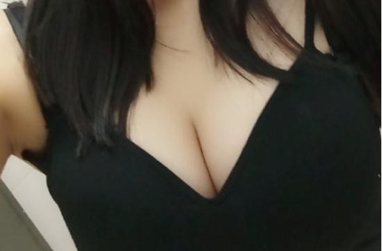 武漢伽美醫(yī)療美容醫(yī)院醫(yī)生朱富初做自體脂肪隆胸怎么樣？看案例