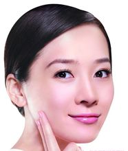 東莞瑞芙臣整形面部填充效果