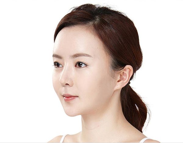 廣州鴻業(yè)醫(yī)學美容門診部下頜角整形