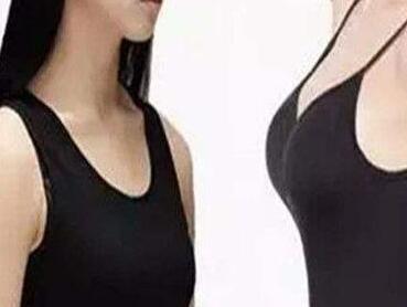 大連沙醫(yī)生整形美容口腔?？漆t(yī)院自體脂肪豐胸