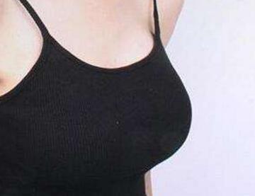 成都美立方醫(yī)療美容醫(yī)院乳房下垂矯正