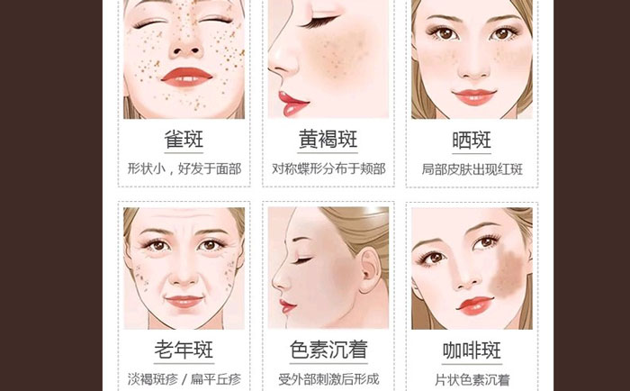醫(yī)院激光祛斑貴不貴？正規(guī)醫(yī)院激光祛斑多少錢？