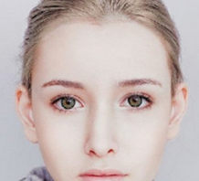 上海南山醫(yī)院美容外科自體軟骨隆鼻