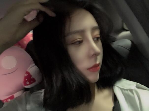 上海時(shí)光整形外科醫(yī)院雙眼皮+隆鼻+下頜角案例