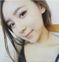 上海時(shí)光整形醫(yī)生何晉龍做假體隆鼻效果怎么樣？附案例效果對比圖