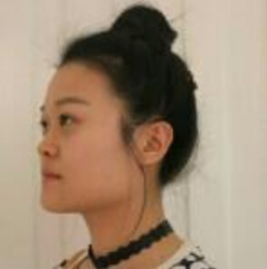 上海時(shí)光整形醫(yī)院左雯君醫(yī)生注射瘦臉針效果怎么樣？附真實(shí)案例圖