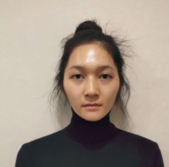 上海時(shí)光整形醫(yī)院做面部玻尿酸注射效果怎么樣？