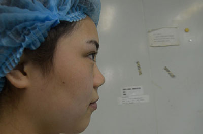 合肥韓美整形醫(yī)院做隆鼻手術(shù)效果怎么樣?附金壽信醫(yī)生案例