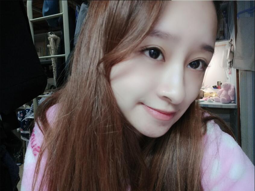 上海時(shí)光整形做玻尿酸注射隆鼻效果怎么樣？附陳文慧醫(yī)生真實(shí)案例對(duì)比圖