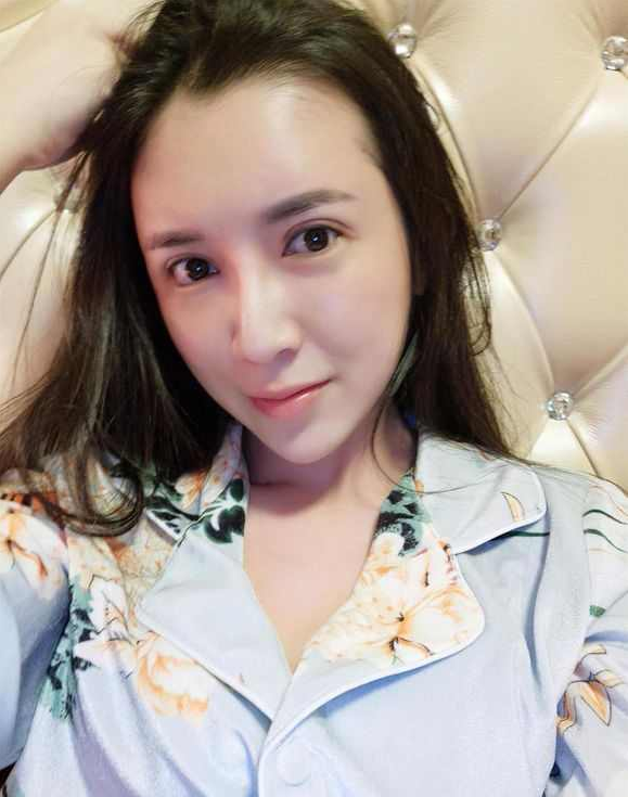 上海時光整形醫(yī)院張晶醫(yī)生做開眼角怎么樣？附真實效果圖