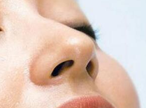 深圳鵬愛(ài)醫(yī)療美容醫(yī)院鼻小柱延長(zhǎng)