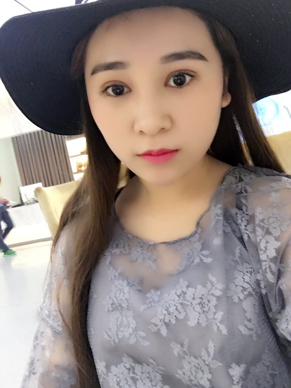 蚌埠韓美美萊整形醫(yī)生鄭捷做開(kāi)眼角怎么樣？附案例效果圖