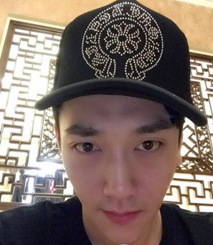 鞍山燕麗醫(yī)療美容醫(yī)院薛媚醫(yī)生做去眼袋效果怎么樣？附案例效果對比圖