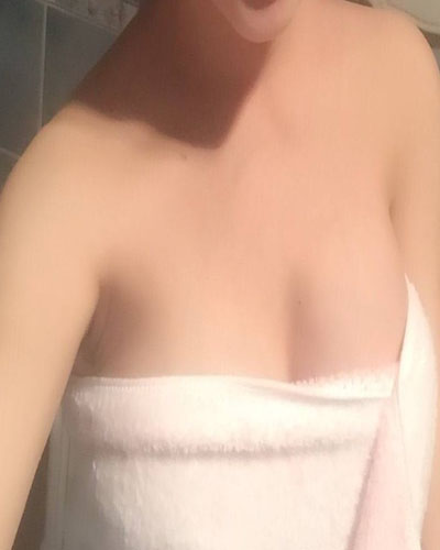 安慶市立醫(yī)院整形外科華棟醫(yī)生做自體脂肪隆胸效果怎么樣？附真實(shí)案例圖