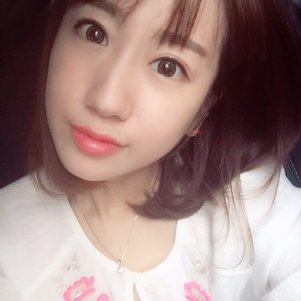 蚌埠韓美美萊整形做玻尿酸面部除皺效果怎么樣？附陳澤醫(yī)生案例效果圖