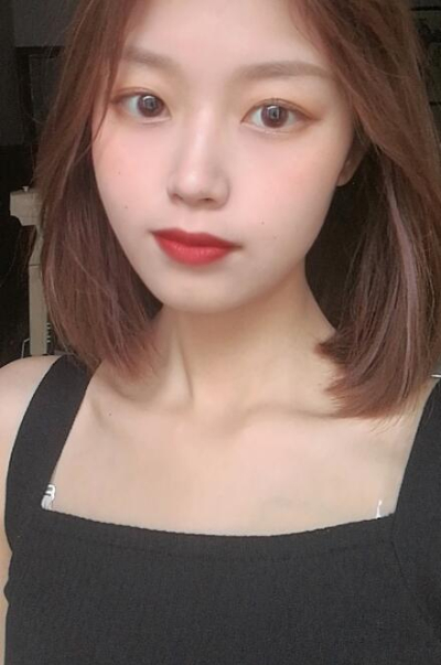 安陽市人民醫(yī)院燒傷整形中心做手術(shù)激光祛斑效果怎么樣？附案例效果對(duì)比圖