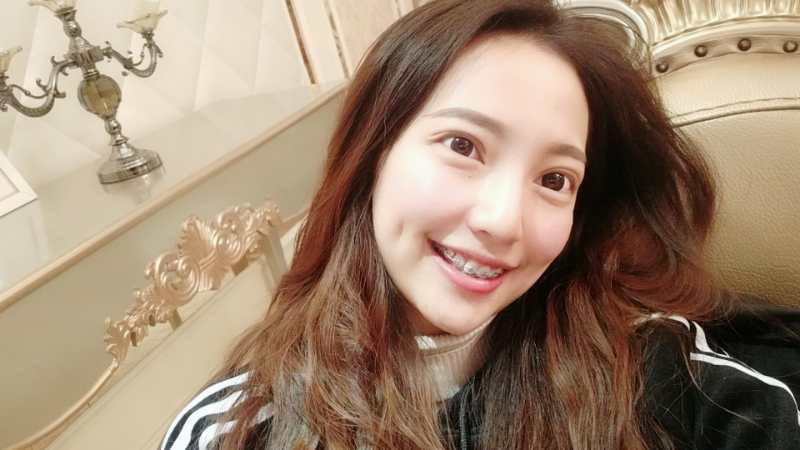 巴中華醫(yī)口腔醫(yī)院做牙齒矯正效果好嗎？附母汶靈醫(yī)生牙齒矯正案例效果圖