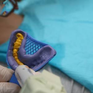 鞍山時(shí)代口腔門診部做瓷貼面案例效果圖