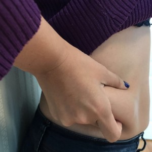 蚌埠韓美美萊整形醫(yī)生張濤做水動(dòng)力吸脂怎么樣？附吸脂案例效果圖